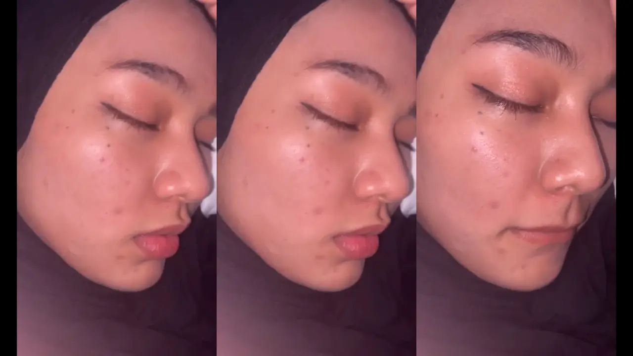 Hijab hitam kesakitan